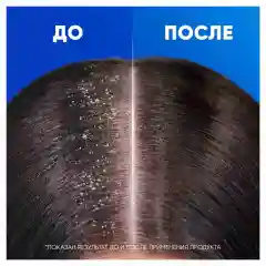 HEAD & SHOULDERS Шампунь против перхоти Sports Fresh 400мл