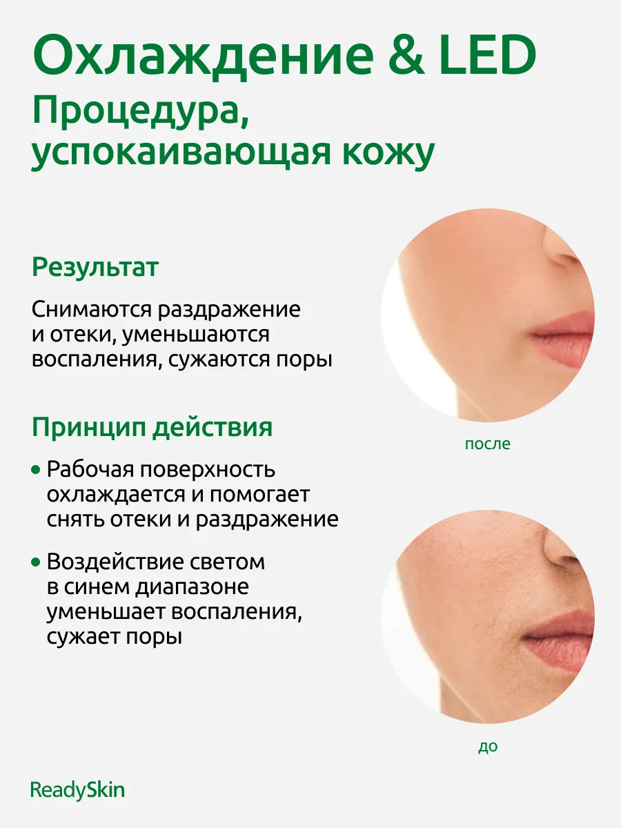 Аппарат Readyskin Eva для омоложения кожи лица, шеи и декольте RF-лифтинг, LED, микротоки