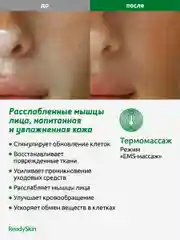 Белый аппарат ReadySkin Octa для очищения и омоложения кожи, микротоки, LED терапия, EMS
