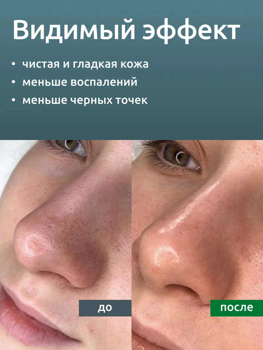 Гель Readyskin Care Ultraclean Gel для ультразвуковой чистки лица