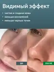 Гель Readyskin Care Ultraclean Gel для ультразвуковой чистки лица