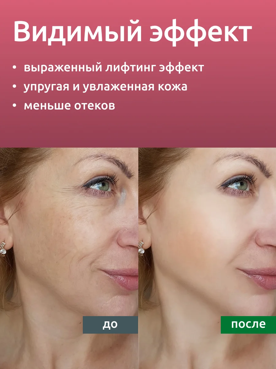 Гель Readyskin Care Lifting Gel контактный токопроводящий для аппаратных процедур