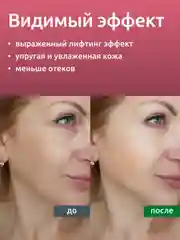 Гель Readyskin Care Lifting Gel контактный токопроводящий для аппаратных процедур