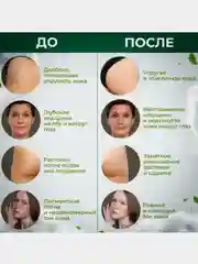 Масло от морщин и отеков лица омолаживающее "Хвощ", для кожи вокруг глаз и век / 108 трав, 30 г