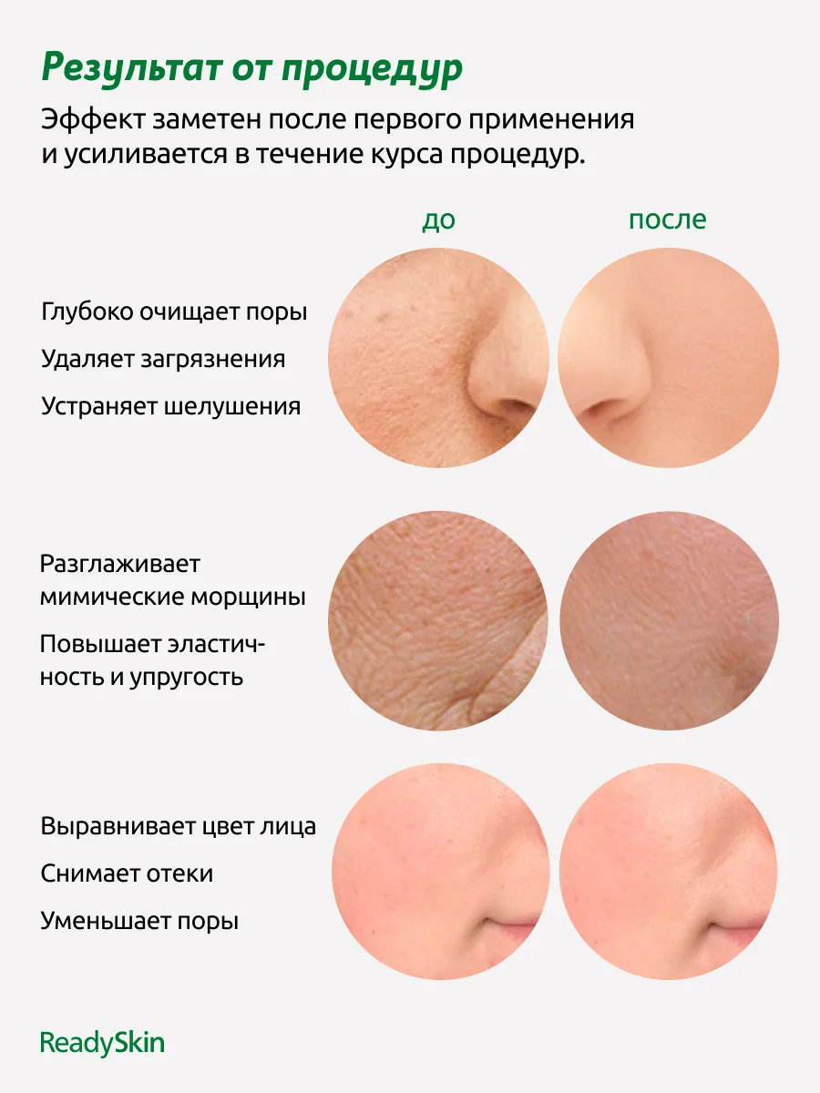 Белый аппарат ReadySkin Glory для ультразвуковой чистки лица с микротоками и лифтингом