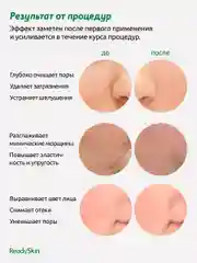 Белый аппарат ReadySkin Glory для ультразвуковой чистки лица с микротоками и лифтингом