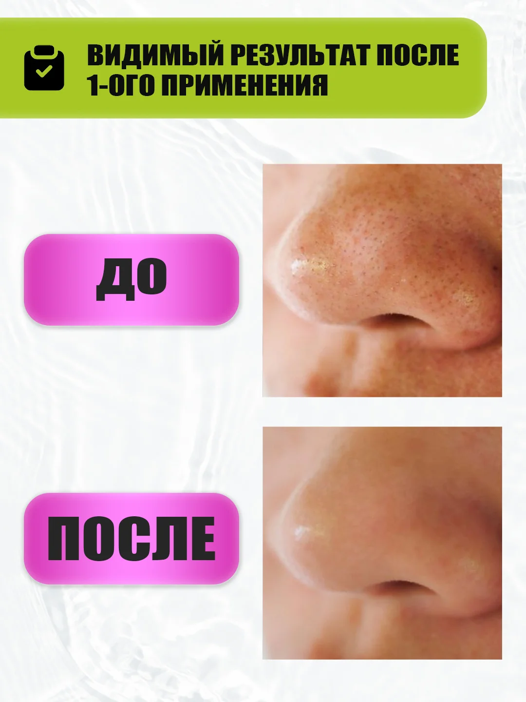 EDEN STOP ACNE Скраб для лица с содой, 75 мл
