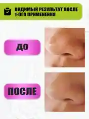 EDEN STOP ACNE Скраб для лица с содой, 75 мл