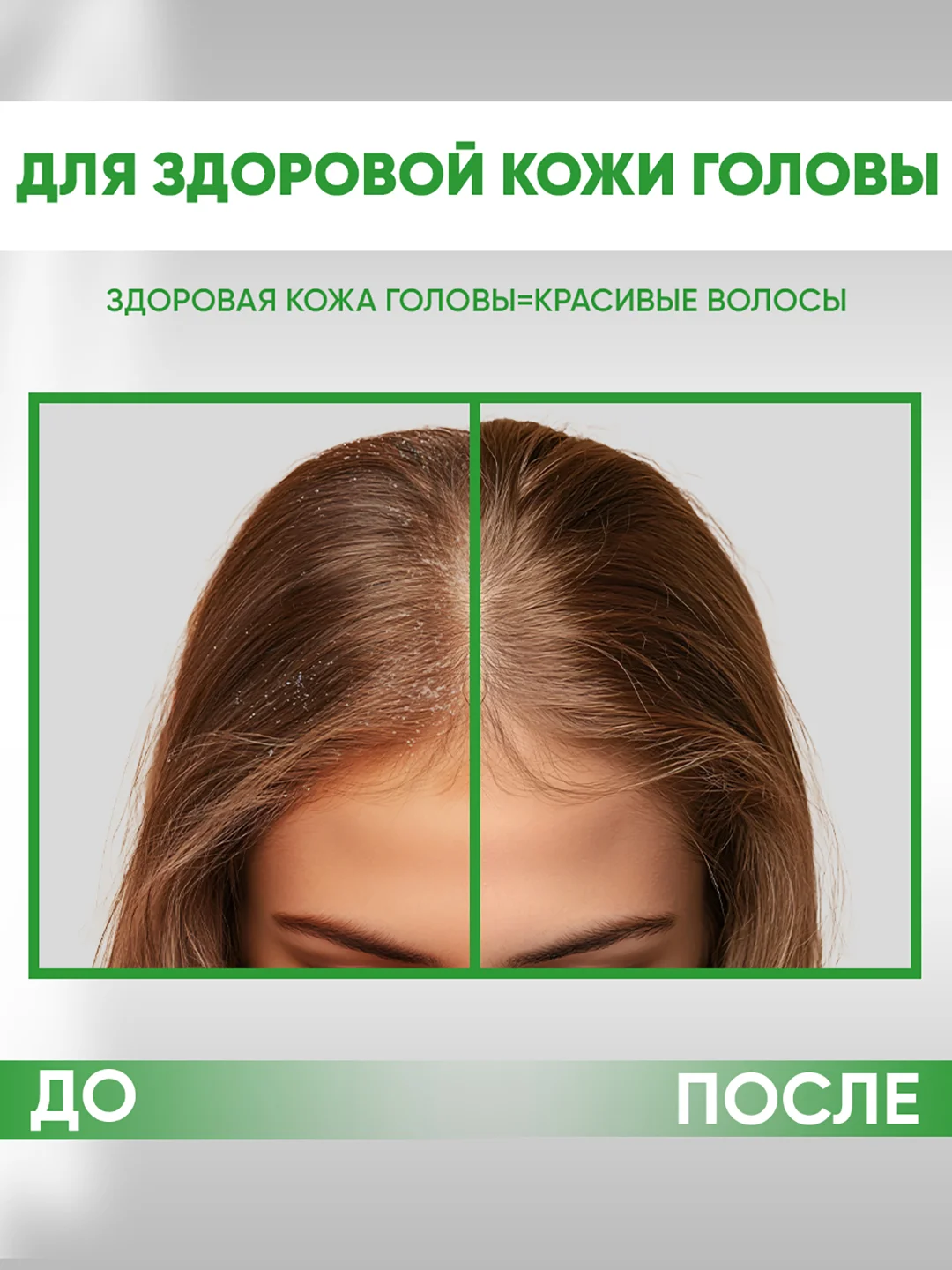 EDEN Cosmetics Пилинг для кожи головы, 100 мл