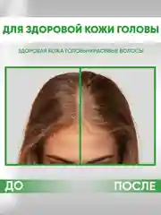 EDEN Cosmetics Пилинг для кожи головы, 100 мл