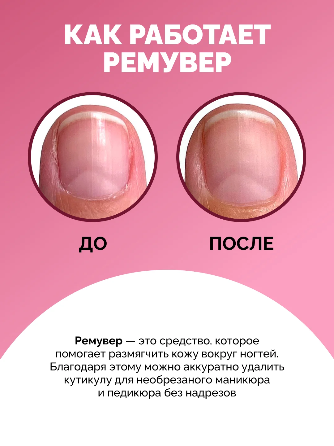 Ремувер кератолитик для удаления кутикулы