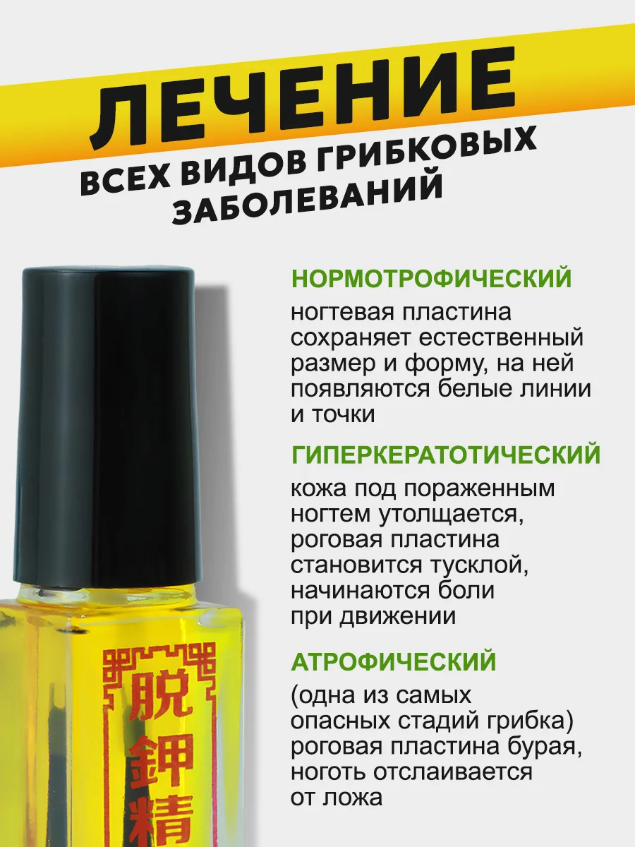Желтый масло для ногтей от грибка, стоп онихолизис, 5 мл