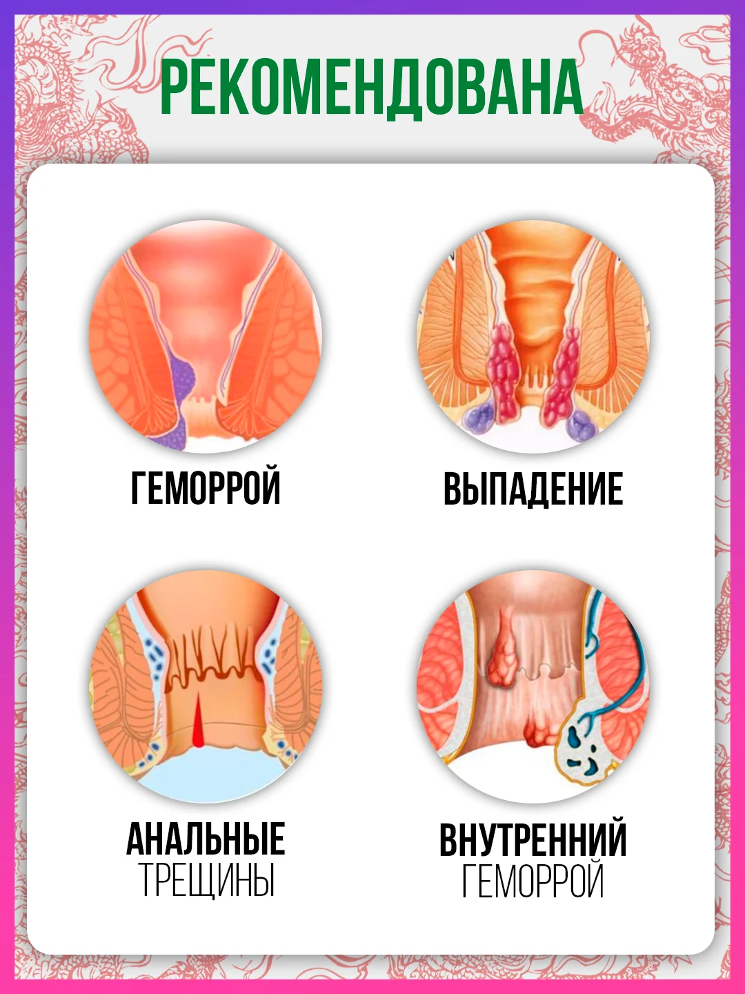 Заживляющая китайская чудо мазь, гель, от всех видов геморроя, натуральный, мускусный крем