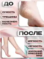 Пемза электрическая для пяток ног,  пилка для пяток, роликовая пилка