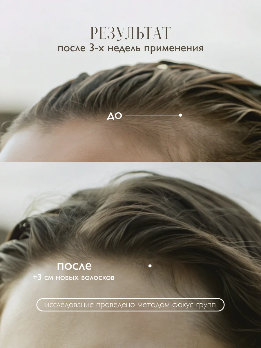 AMBREE Professional Маска с перцем для роста волос и укрепления, кератиновая 400 мл