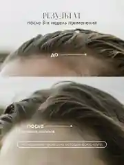 AMBREE Professional Маска с перцем для роста волос и укрепления, кератиновая 400 мл
