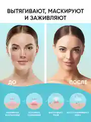 Патчи от прыщей 144 шт салициловая кислота и масло чайного дерева