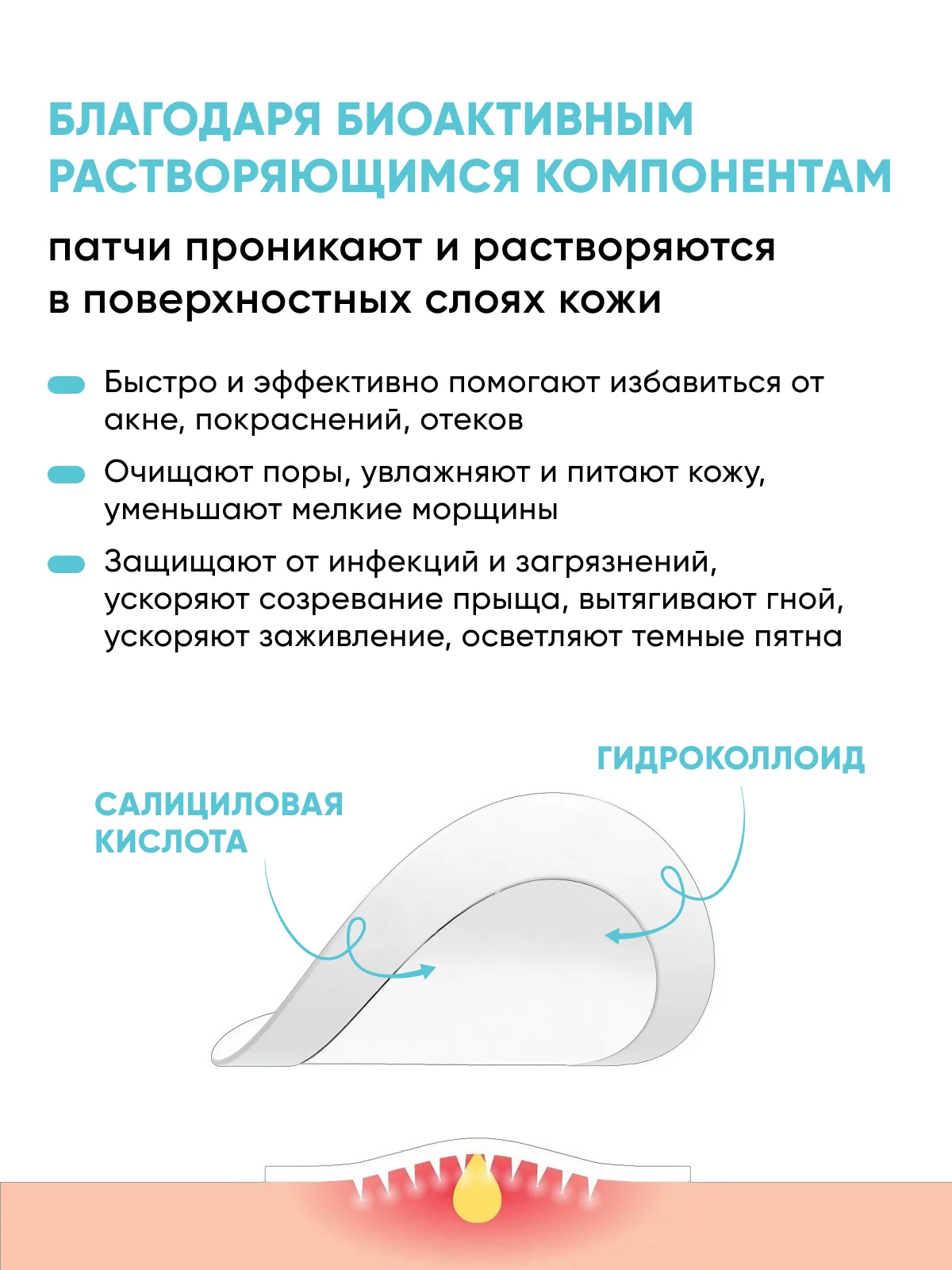 Патчи от прыщей 144 шт салициловая кислота и масло чайного дерева