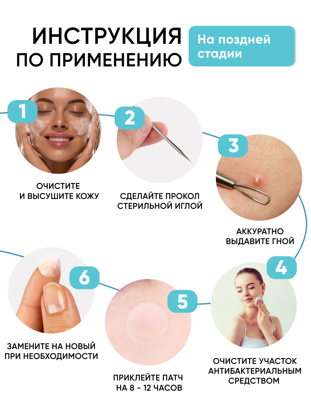 Патчи от прыщей 144 шт салициловая кислота и масло чайного дерева