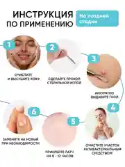 Патчи от прыщей 144 шт салициловая кислота и масло чайного дерева