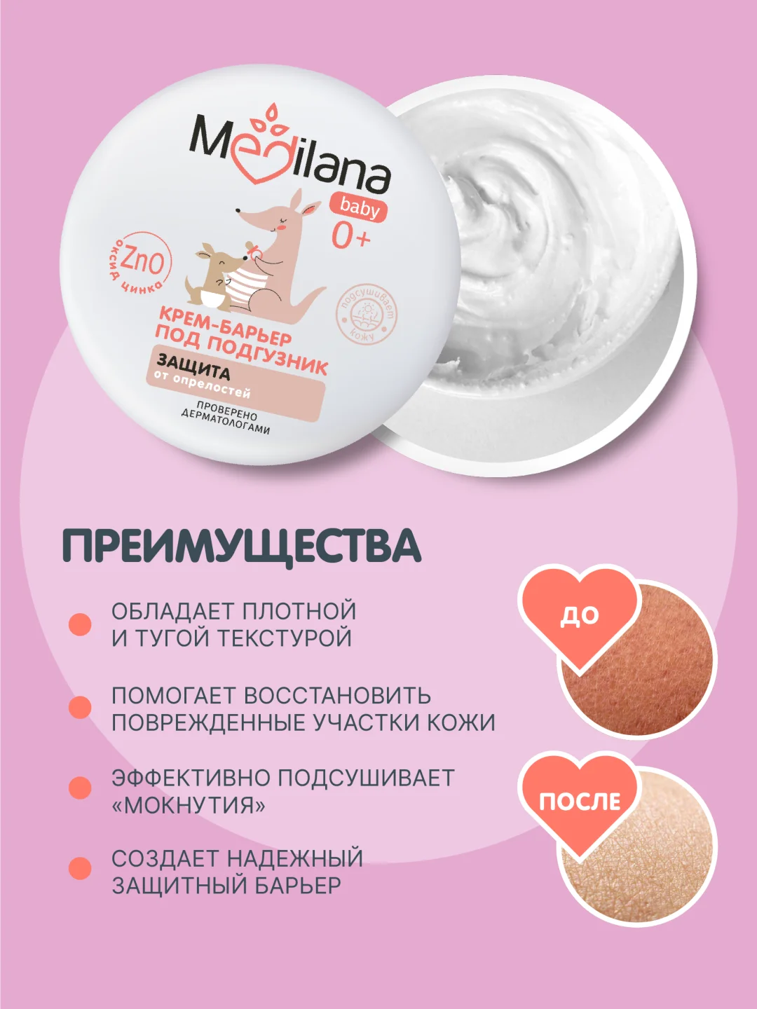MEDILANA Крем-барьер под подгузник, защита от опрелостей, 50 г