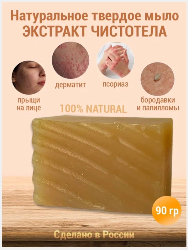 Живое мыло "Чистотел" от прыщей, угрей при псориазе, дерматите