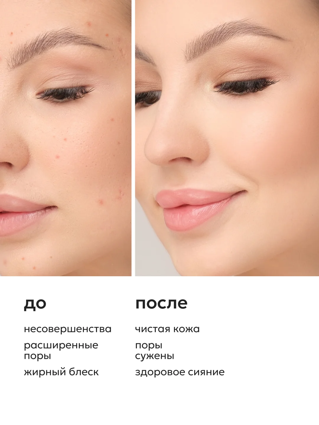 Энзимная пудра от прыщей, черных точек, постакне с папаином, 150 мл, Likato Professional