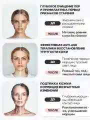 Невотон АК-201 косметологический аппарат, лифтинг, электрофорез, дезинкрустация, уход за лицом