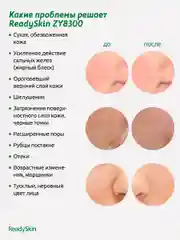 Голубой аппарат ReadySkin ZY8300 для ультразвуковой чистки, ионофореза, микро и термомассажа лица
