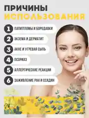 Крем от папиллом и бородавок Чистотел с Эвкалиптом от дерматита, экземы -  50 мл